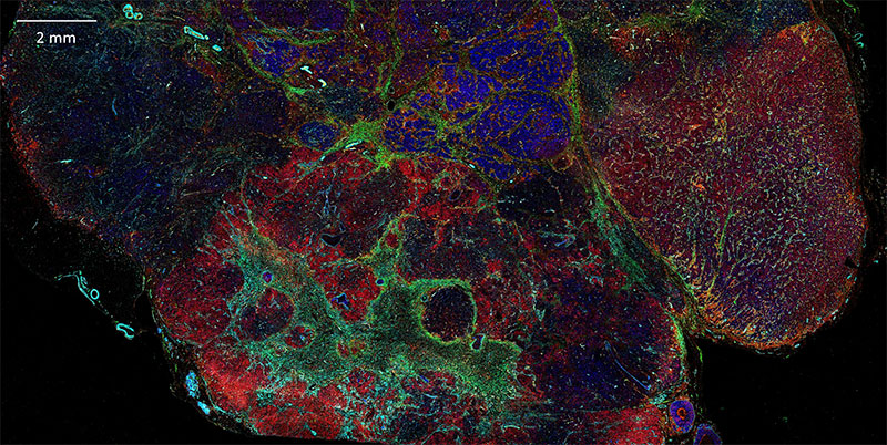 Human Immuno-Oncology Spatial Imagery